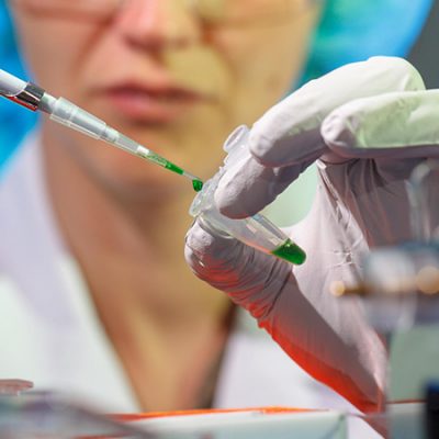 Mujer En Laboratorio Realizando Un Test